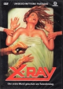 X-Ray - Der erste Mord geschah am Valentinstag (uncut)